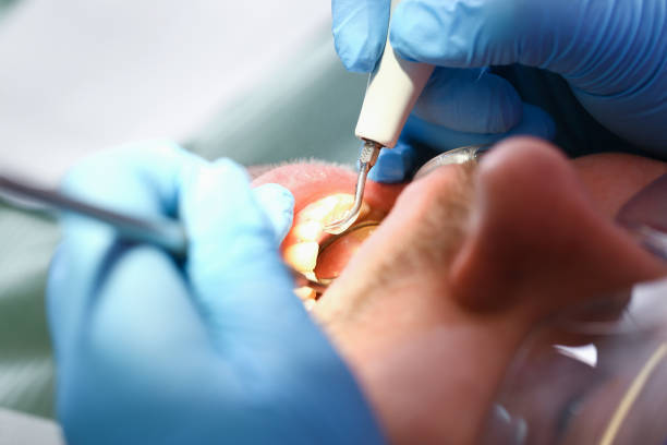 Best Emergency TMJ Treatment in Hayfield, VA